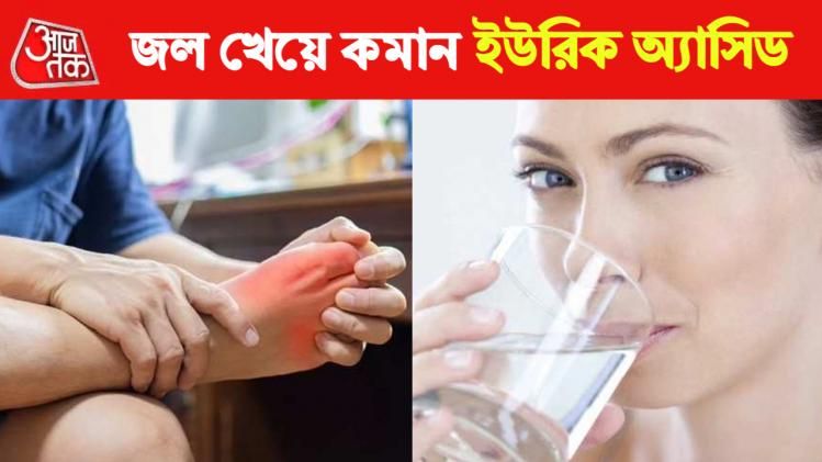 জাস্ট জল খেয়েই কমান ইউরিক অ্যাসিড, রইল ২ আয়ুর্বেদিক টোটকা জাস্ট জল খেয়েই কমান ইউরিক অ্যাসিড, রইল ২ আয়ুর্বেদিক টোটকা