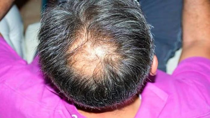 প্রতীকী ছবি