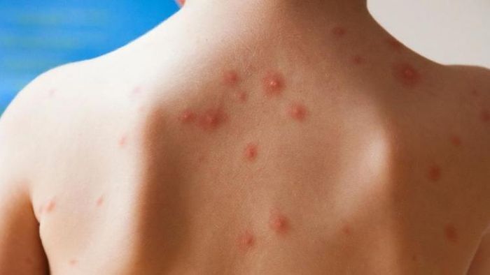 ফাইল ছবি।