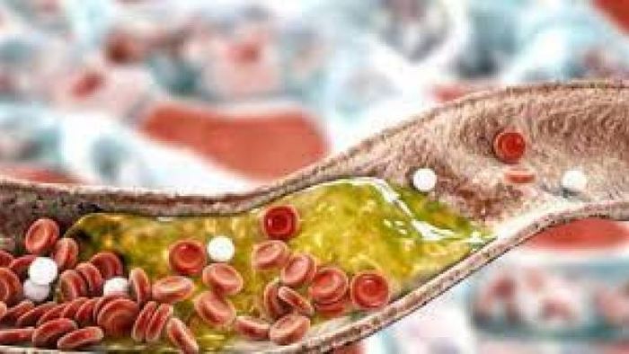 হাফ গ্লাস জলেই হবে কামাল, হু হু করে কমবে কোলেস্টেরল; কীভাবে?