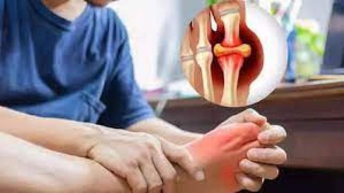 শরীরে হাই ইউরিক অ্যাসিড থাকা একটি বিপজ্জনক অবস্থা