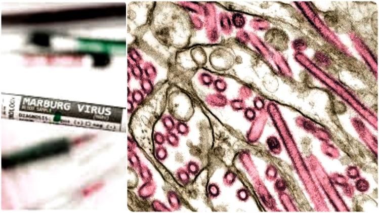 দ্রুত ছড়াচ্ছে মারবার্গ ভাইরাস, মৃত্যুর হার ৮৮%