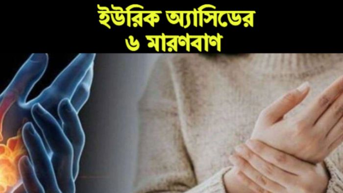 ইউরিক অ্যাসিডের প্রতিকার।