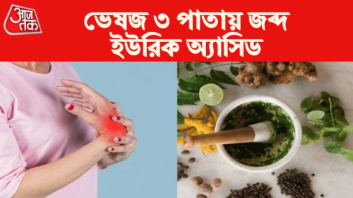 ইউরিক অ্যাসিড কমানোর টিপস। Uric Acid Control Tips