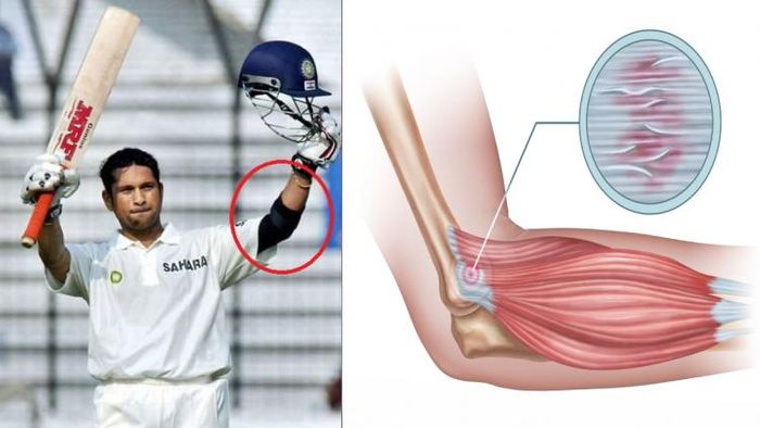 টেনিস এলবোর সমস্যায় ভুগেছিলেন সচিন