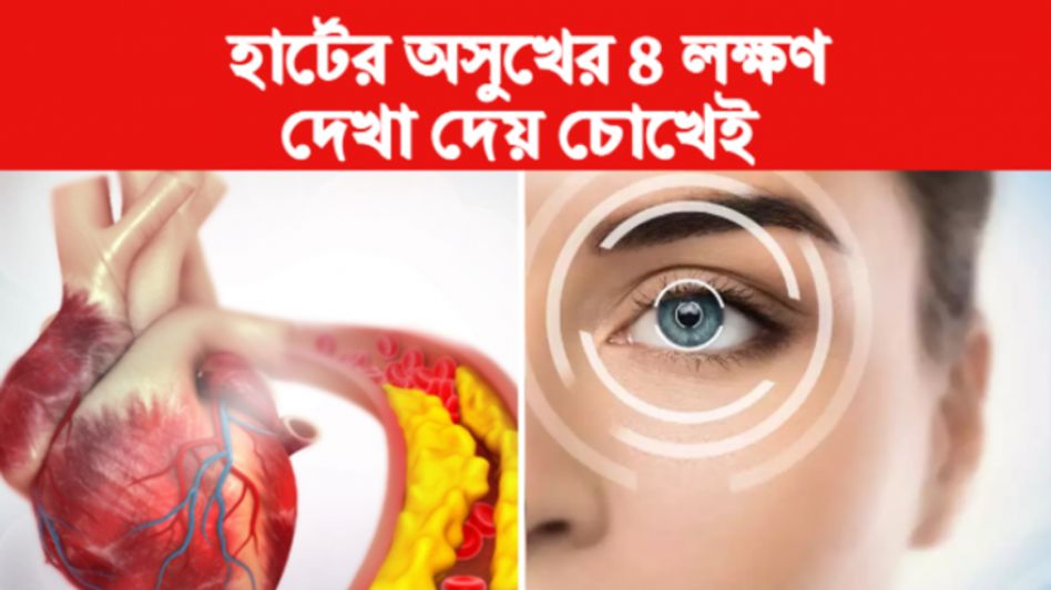 হার্টের অসুখের এই ৪ লক্ষণ দেখা দেয় চোখেই, বুকে ব্যথার আগেই জানুন  হার্টের অসুখের এই ৪ লক্ষণ দেখা দেয় চোখেই, বুকে ব্যথার আগেই জানুন