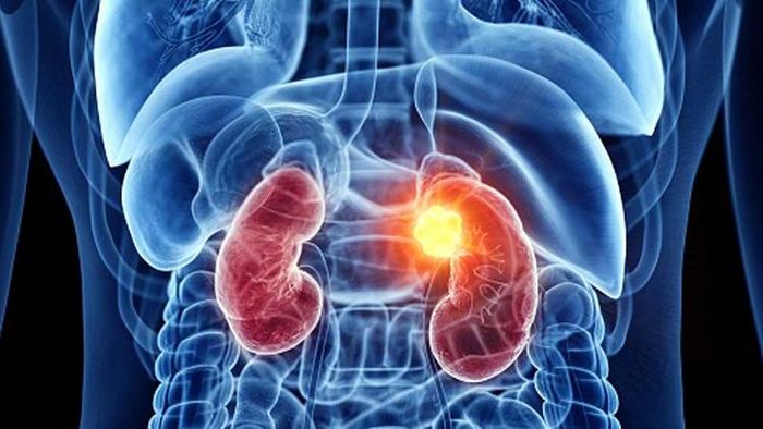 খুব সহজে কিডনিকে সুস্থ রাখুন এভাবে