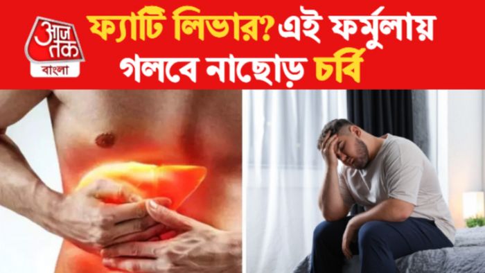 fatty liver remedies