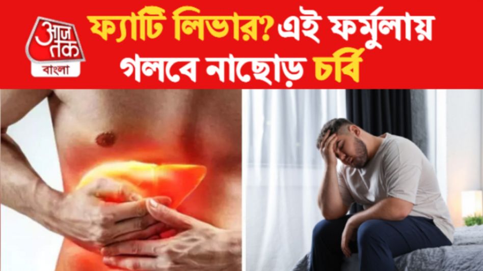ফ্যাটি লিভার থেকে চিরতরে মুক্তি, খালি মেনে চলুন ৫-৫ টোটকা         ফ্যাটি লিভার থেকে চিরতরে মুক্তি, খালি মেনে চলুন ৫-৫ টোটকা