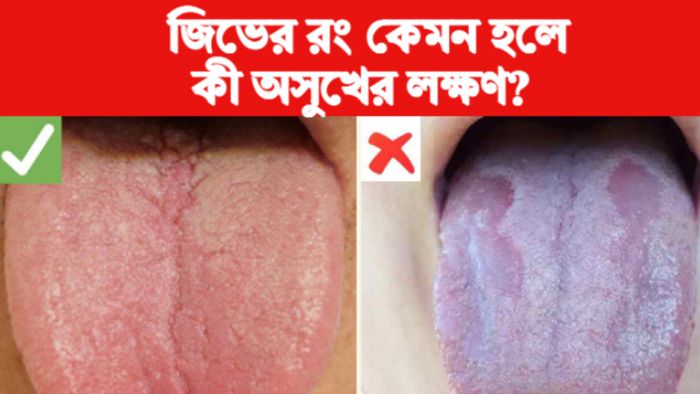 Tongue Health জিভের স্বাস্থ্য।