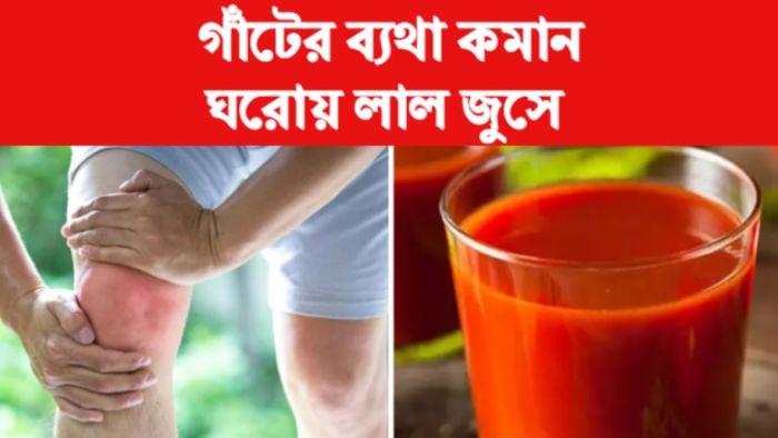 Uric Acid Control Tips ইউরিক অ্যাসিড নিয়ন্ত্রণের টিপস।