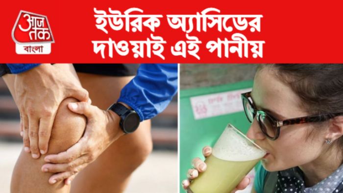 Uric Acid Control Tips ইউরিক অ্যাসিড নিয়ন্ত্রণের টিপস।