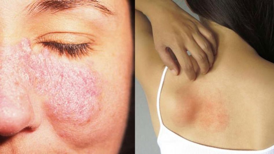 Qora va oq ayol ortasidagi fotosuratlar va jinsiy aloqani koring Qora va oq ayol ortasidagi fotosuratlar va jinsiy aloqani koring