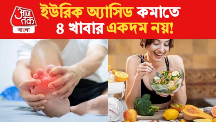 Uric Acid Control Tips