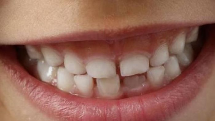 Samudrik Shastra: দু'টি দাঁতের মাঝে ফাঁক আছে? সমুদ্রশাস্ত্রে যা ভবিষ্যৎ বলছে