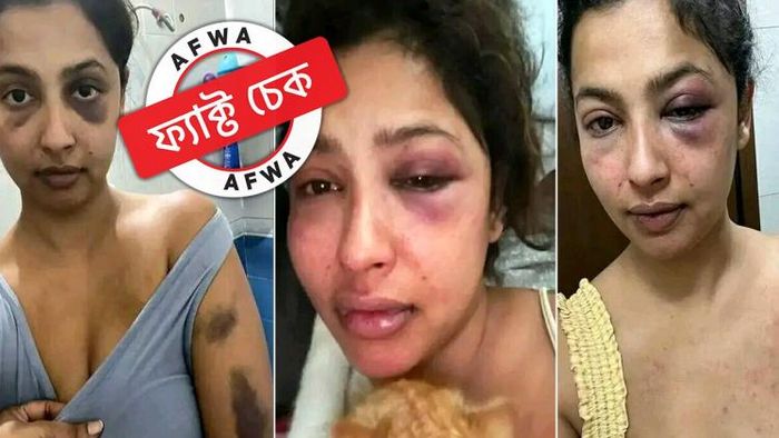 লাভ জিহাদ' নয়! ভাইরাল ছবিটি এক দক্ষিণী অভিনেত্রীর, যিনি প্রাক্তন প্রেমিকের নিগ্রহের শিকার হন