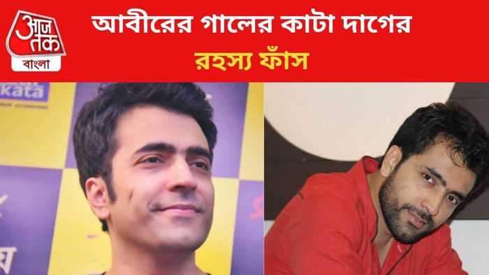 আবীর চট্টোপাধ্যাের গালে কাটা দাগের পিছনের কারণ কী