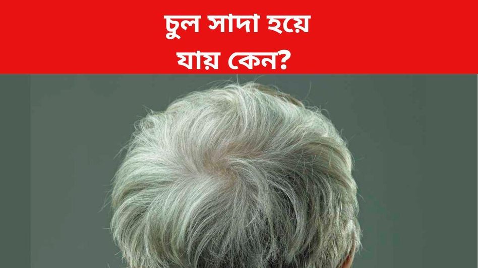 অল্প বয়সেই চুল পেকে যাচ্ছে? গবেষণায় জানা গেল আসল কারণ অল্প বয়সেই চুল পেকে যাচ্ছে? গবেষণায় জানা গেল আসল কারণ