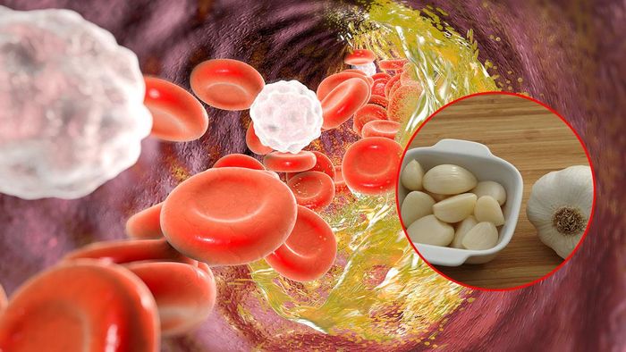 রসুনে কমবে কোলেস্টেরল
