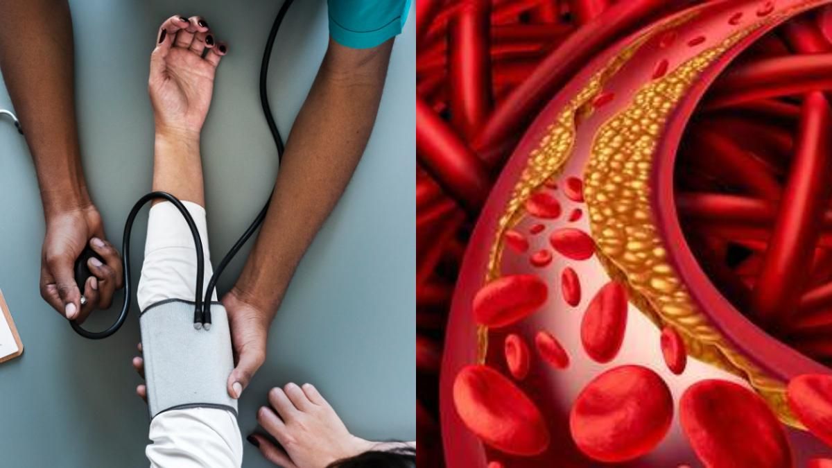 শরীর এমন সঙ্কেত দিলেই সাবধান, খারাপ কোলেস্টেরল বাড়ার আগেই সতর্ক হোন!