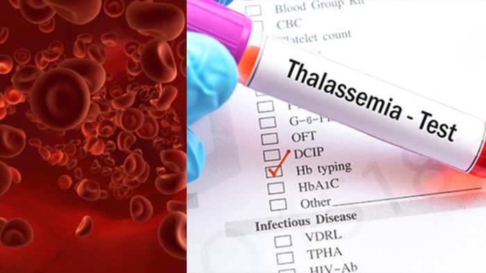 উপসর্গ ছাড়াই শরীরে লুকিয়ে থাকতে পারে থ্যালাসেমিয়া, এই লক্ষণগুলি দেখলেই সতর্ক হোন