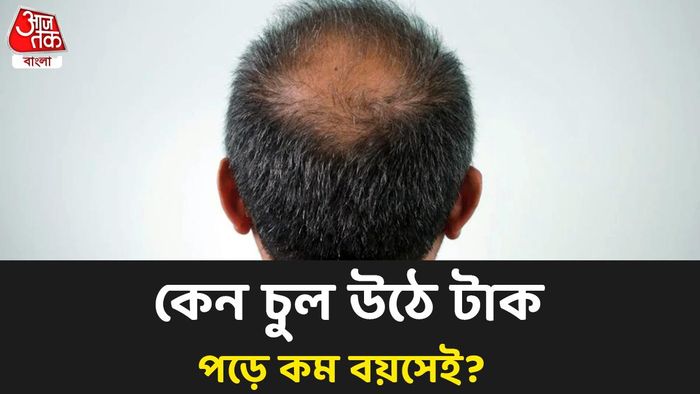 প্রতীকী ছবি