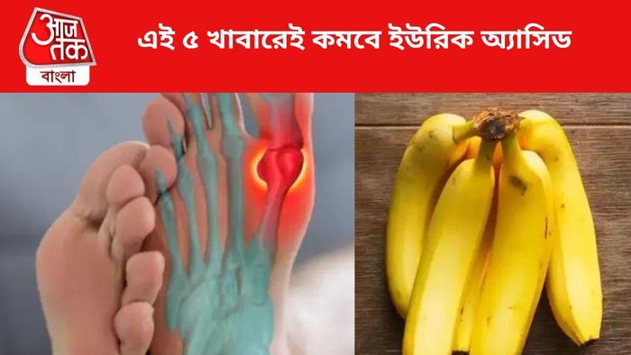 এই ৫ খাবারেই কমবে ইউরিক অ্যাসিড