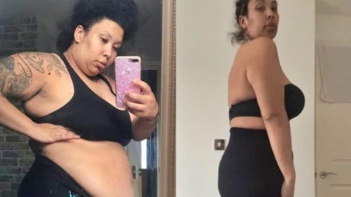 ৩ লাখ খরচ করে ৫০ কেজি ওজন কমালেন ১৩৯ কেজি মহিলা