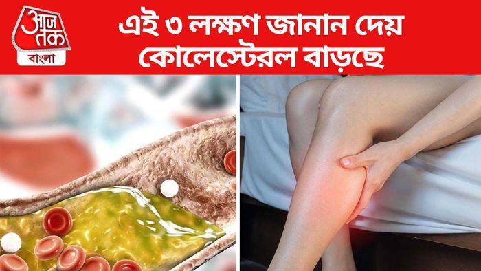 দেরি করলেই হার্ট অ্যাটাকের ঝুঁকি বাড়বে