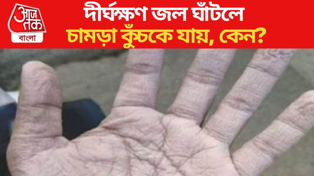 দীর্ঘক্ষণ জলের কাজ করলে কেন হাতের চামড়া কুঁচকে যায়? জানুন