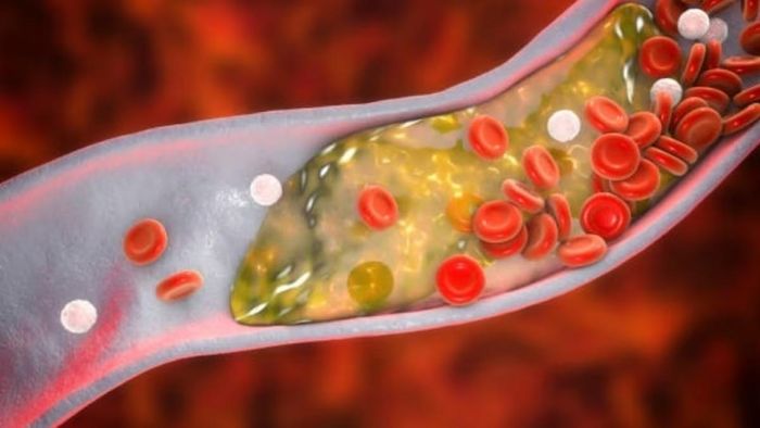 ফাইল ছবি।