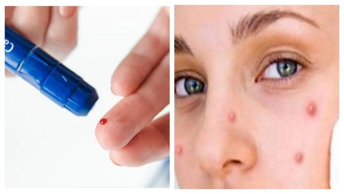 প্রতীকী ছবি