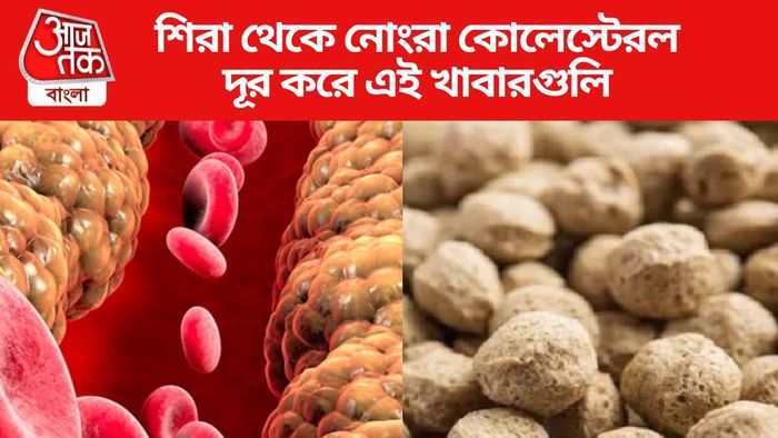 কিছু খাবার খারাপ কোলেস্টেরল কমায়