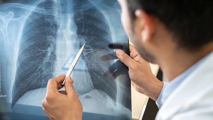 প্রতীকী ছবি।