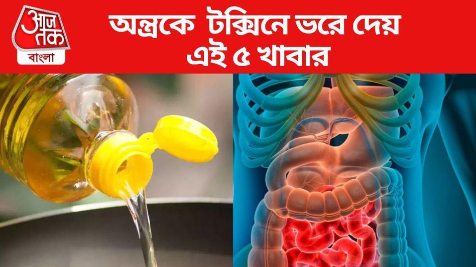 সাবধান! আপনার পরিপাকতন্ত্রকে বিষাক্ত পদার্থে ভরে দিচ্ছে রোজকার এই ৫ খাবার সাবধান! আপনার পরিপাকতন্ত্রকে বিষাক্ত পদার্থে ভরে দিচ্ছে রোজকার এই ৫ খাবার