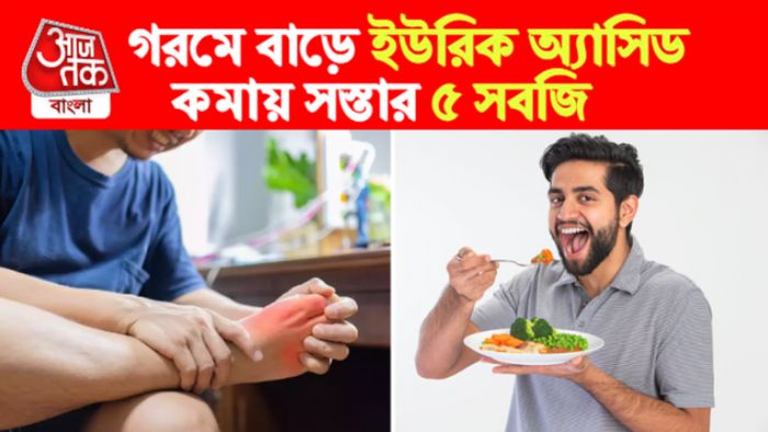 Uric Acid Control Tip। ইউরিক অ্যাসিড নিয়ন্ত্রণের টিপস।