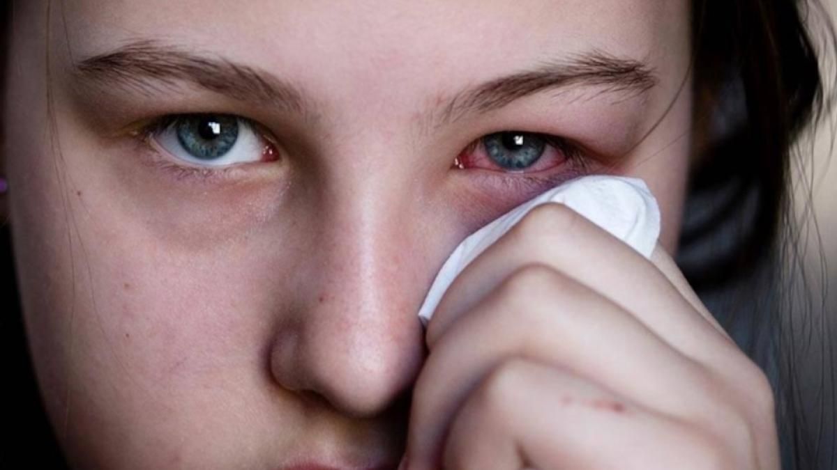 দিল্লি, গুজরাত আর পশ্চিমবঙ্গের কিছু অংশে কনজেক্টিভাইটিসের সমস্যাও লাফিয়ে লাফিয়ে বাড়ছে। 