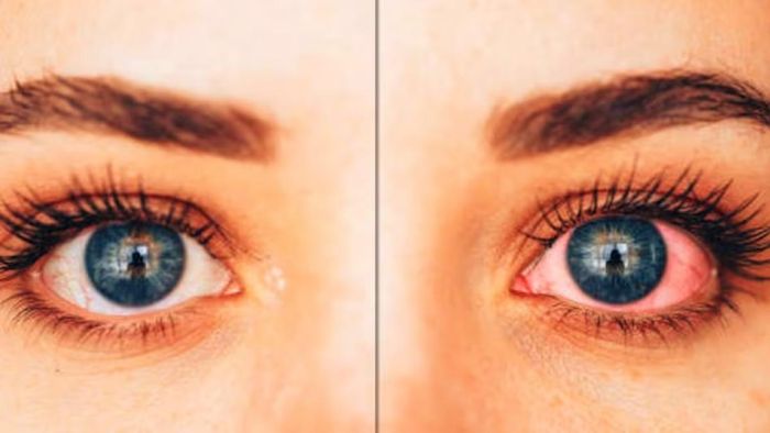 ফাইল ছবি।