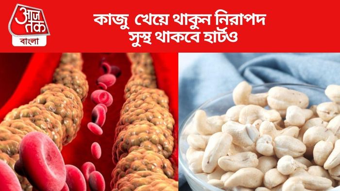 কাজু খেয়ে থাকুন নিরাপদ