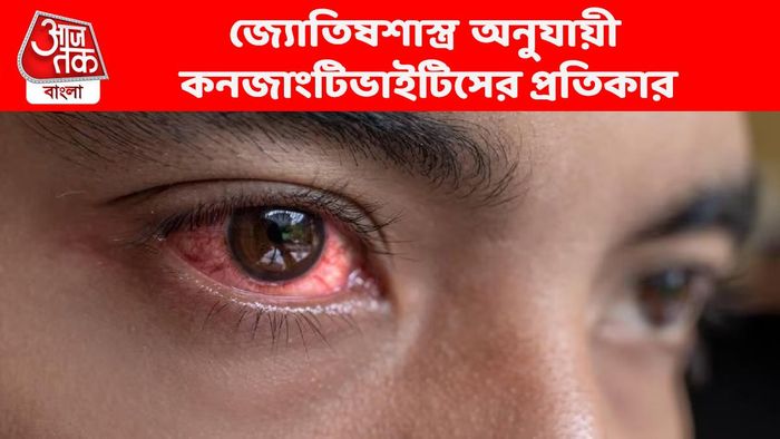 কনজাংটিভাইটিস হবে কি না কুণ্ডলীতেই জানা যায়, রয়েছে প্রতিকারও