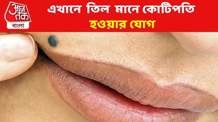 এখানে তিল থাকলে কোটিপতি হওয়া কেউ ঠেকাতে পারবে না