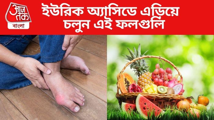 ইউরিক অ্যাসিডে এড়িয়ে চলুন এই ফলগুলি