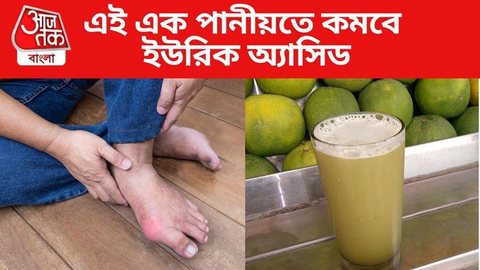 ইউরিক অ্যাসিড কমবে এই এক পানীয়তে