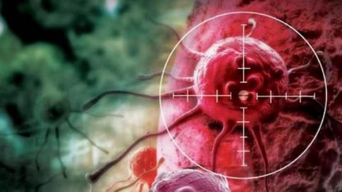 গোড়াতেই ক্যান্সার ? এই ৫ লক্ষণে শনাক্ত করুন প্রথম স্টেজেই