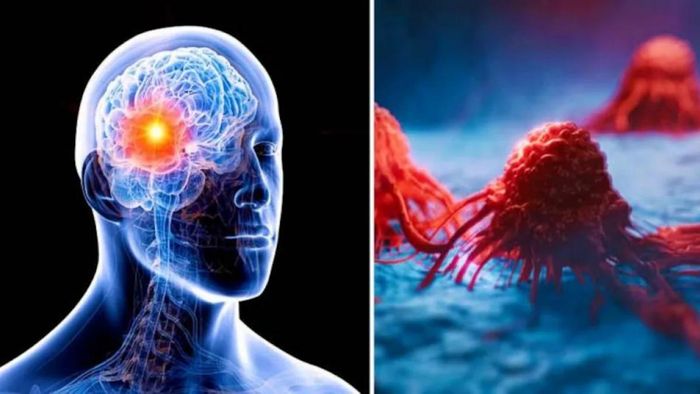 প্যারালাইসিস রুখে দেয় এই ফল, হিসেব করে খেলে মহৌষধি