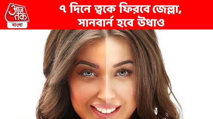 ৭ দিনে ভোল বদলাবে, ত্বকে ফিরবে জেল্লা; গায়েব হবে সানবার্ন