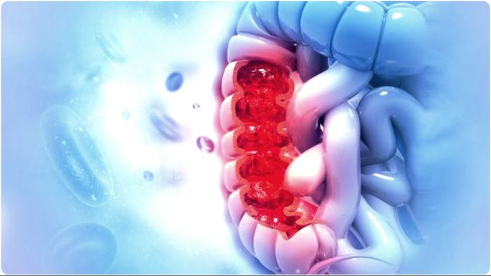 প্রায়ই জ্বর-সর্দি-কাশি ভোগাচ্ছে? সাবধান, রেকটাল ক্যান্সারের লক্ষণগুলিও এমনই!