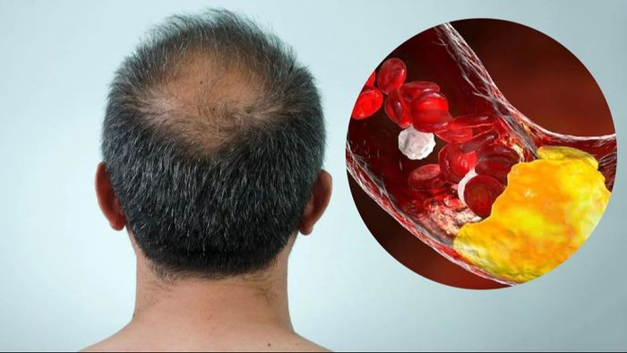 প্রতীকী ছবি