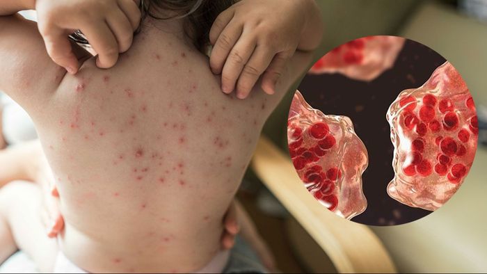 প্রতীকী ছবি