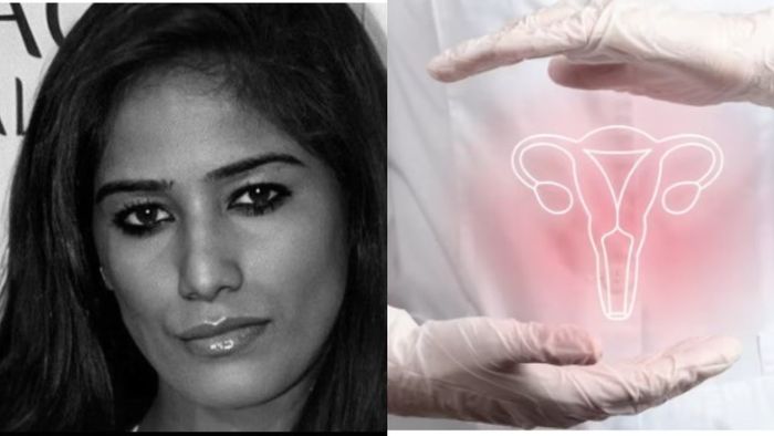 সার্ভিক্যাল ক্যানসারে আক্রান্ত হয়ে প্রয়াত পুনম পান্ডে।